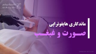 ماندگاری هایفوتراپی صورت و غبغب