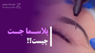 پلاسما جت چیست