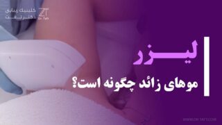 لیزر موهای زائد بدن چگونه است؟