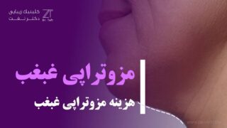 مزوتراپی غبغب و هزینه مزوتراپی غبغب