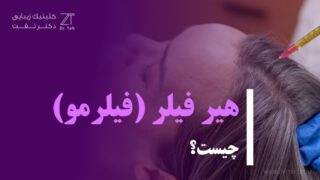 هیر فیلر چیست