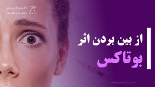 از بین بردن اثر بوتاکس