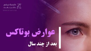 عوارض بوتاکس بعد از چندسال