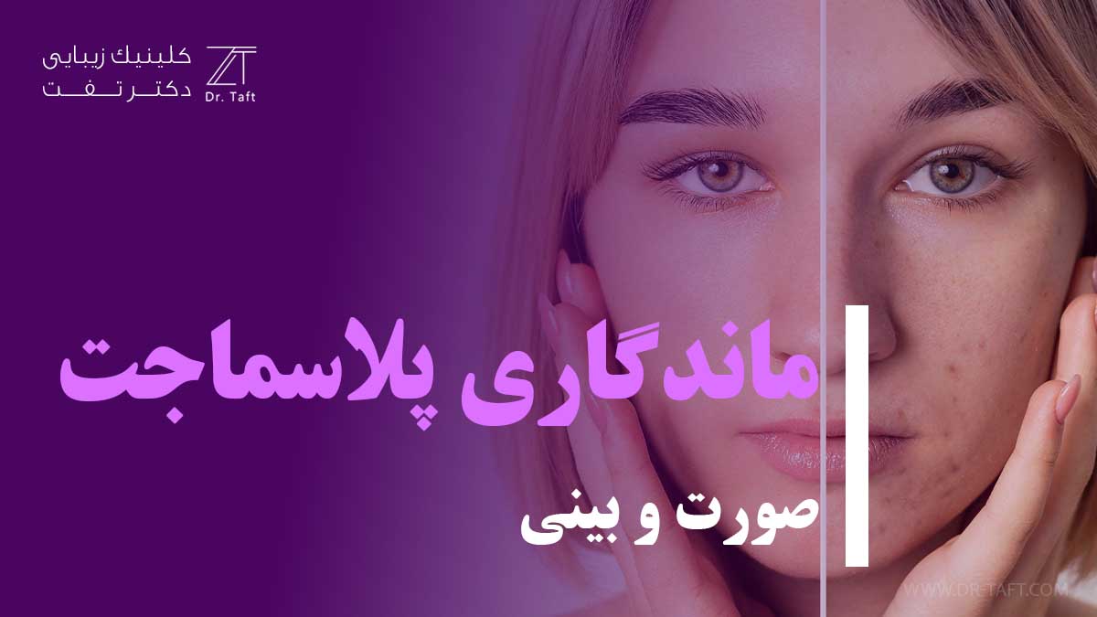 ماندگاری پلکسر پلک و بینی