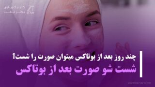 چند روز بعد از بوتاکس میتوان صورت را شست + حمام بعد از بوتاکس
