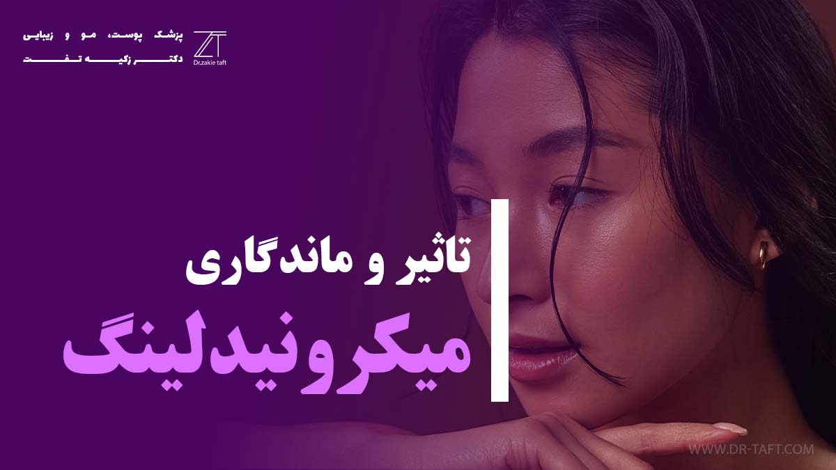 تاثیر و ماندگاری میکرونیدلینگ