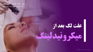 علت لک بعد از میکرونیدلینگ چیست