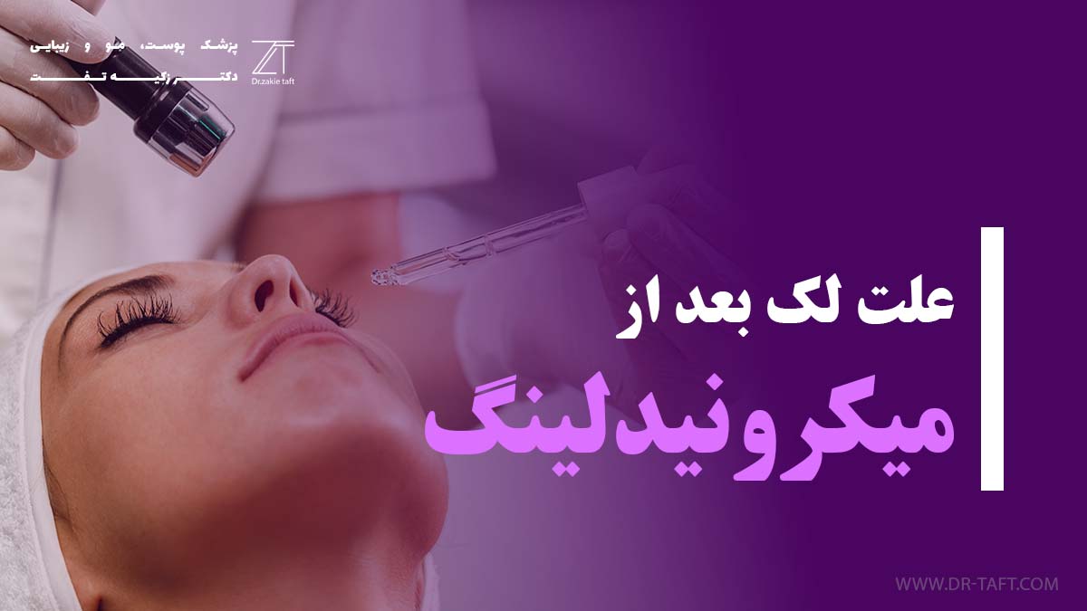 علت لک بعد از میکرونیدلینگ چیست