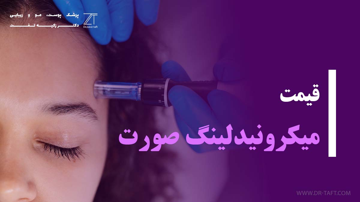 قیمت میکرونیدلینگ صورت