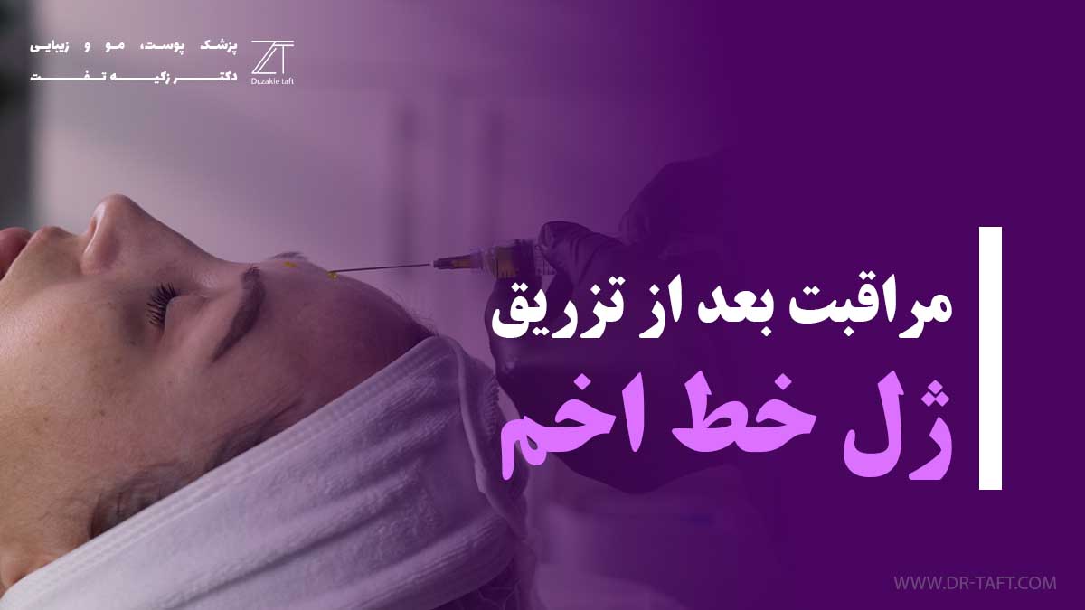نکات مراقبت بعد از تزریق ژل خط اخم