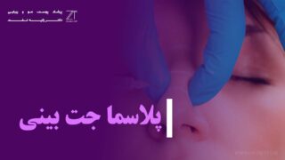 پلاسما جت بینی