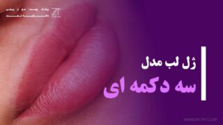 ژل لب مدل سه دکمه ای