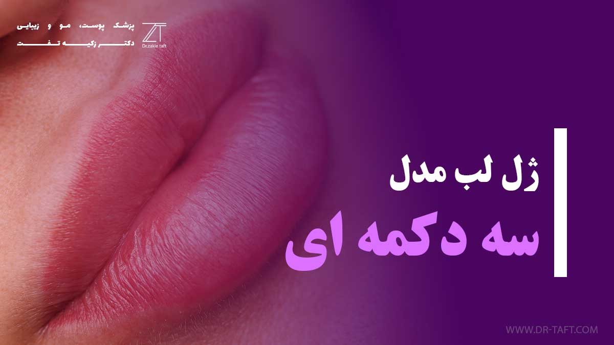 ژل لب مدل سه دکمه ای