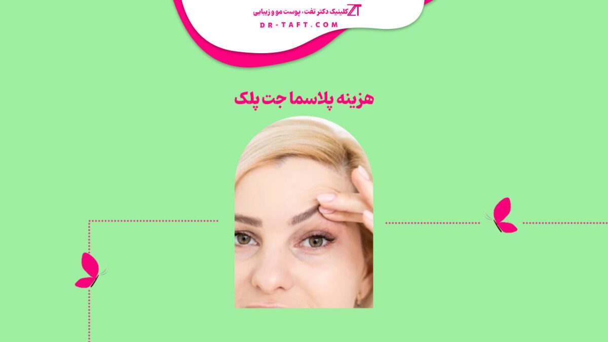 هزینه پلاسما جت پلک