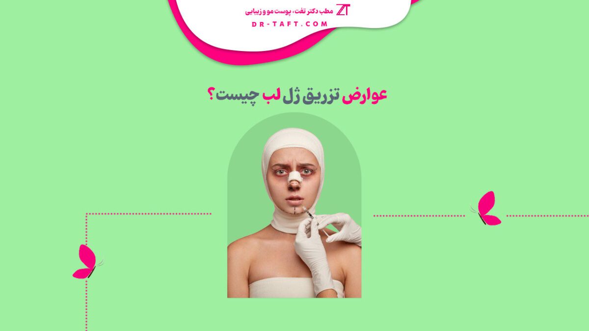 عوارض ژل لب چیست