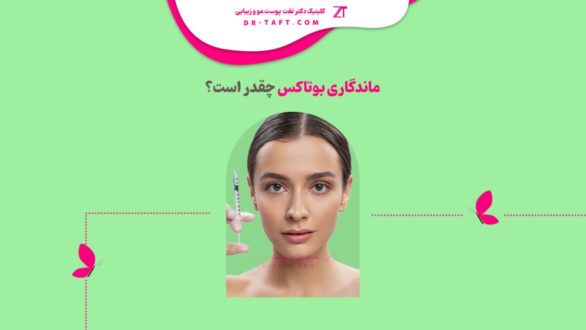 ماندگاری بوتاکس چقدر است