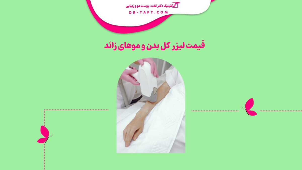 قیمت لیزر کل بدن و موهای زائد