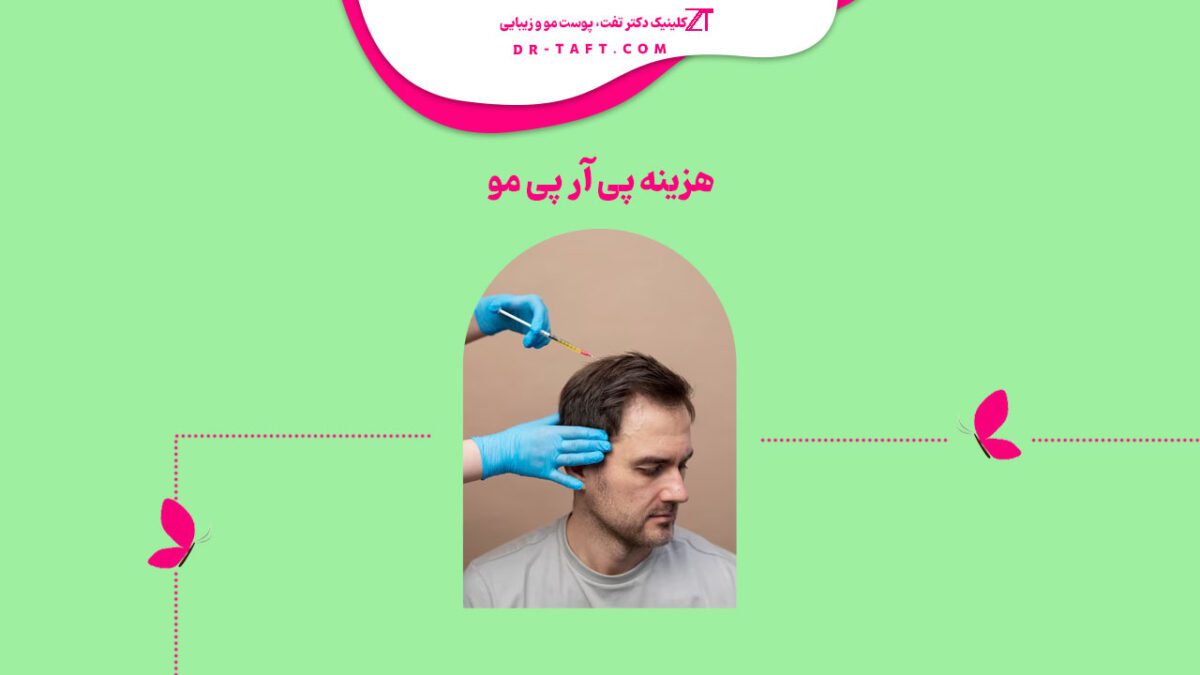 هزینه پی آر پی مو