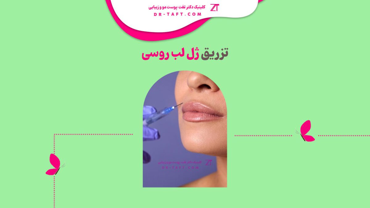 مدل لب روسی طبیعی