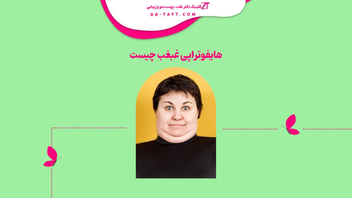 هایفوتراپی غبغب چیست