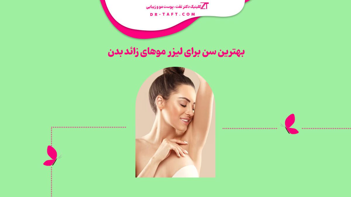 بهترین سن برای لیزر موهای زائد بدن