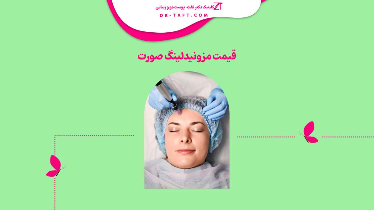 قیمت مزونیدلینگ صورت