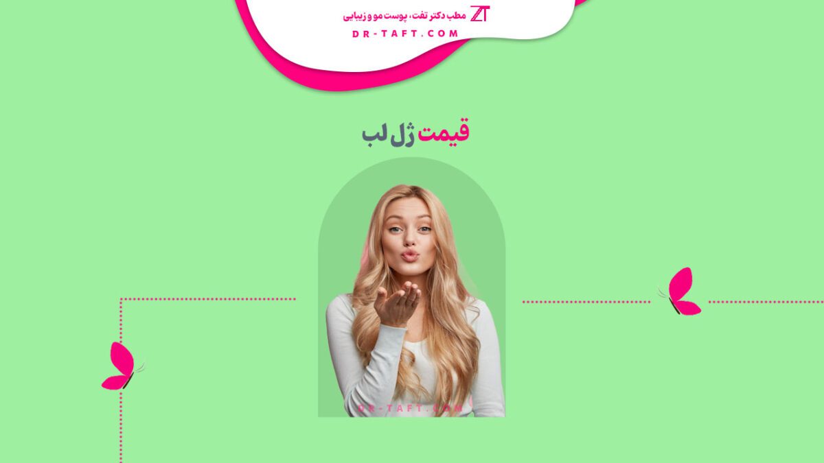 قیمت ژل لب روسی و طبیعی