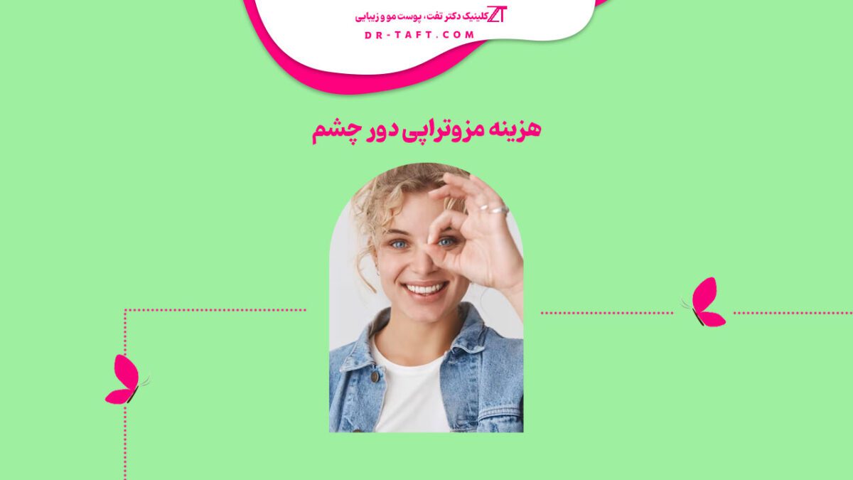 هزینه مزوتراپی دور چشم