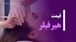 هزینه تزریق فیلر مو