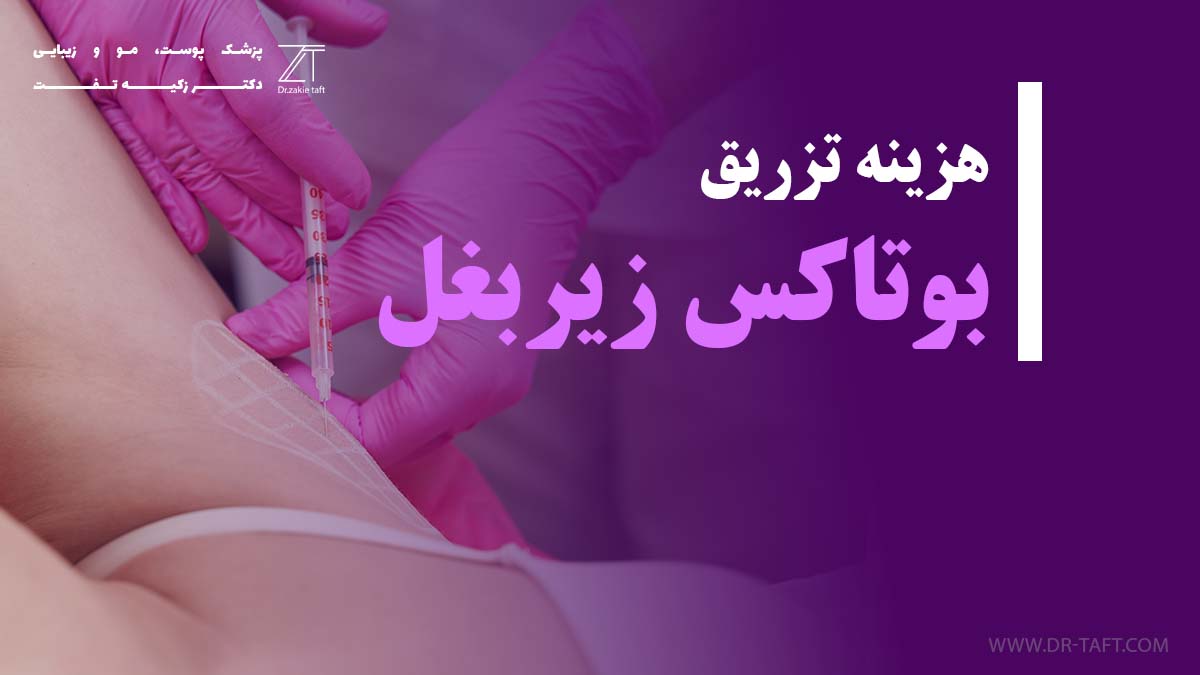 هزینه تزریق بوتاکس زیر بغل