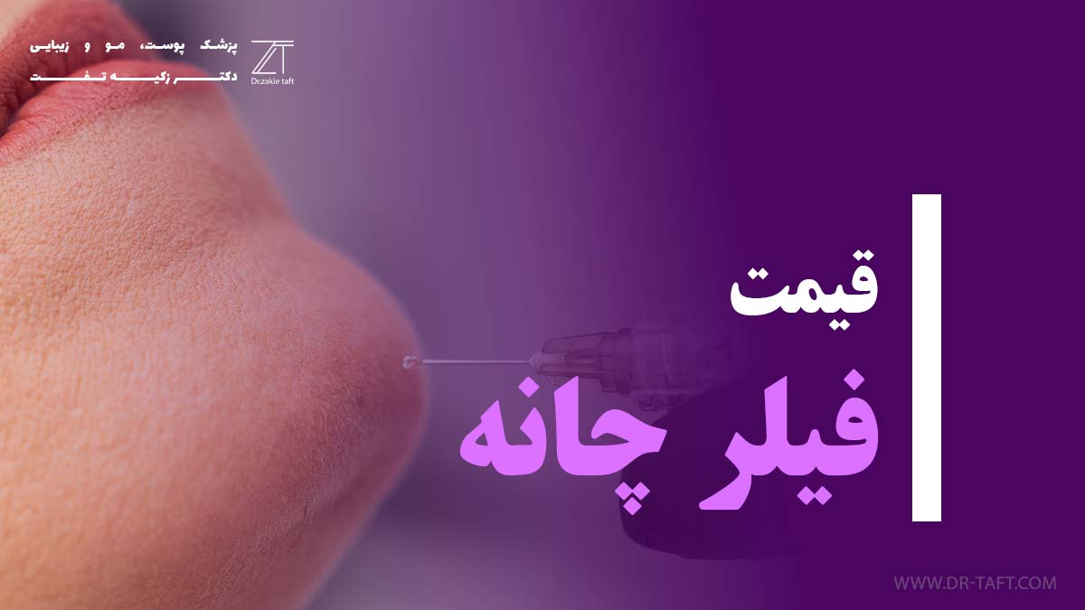 هزینه تزریق ژل چانه