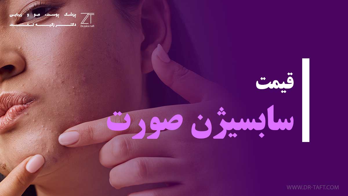 قیمت سابسیژن صورت