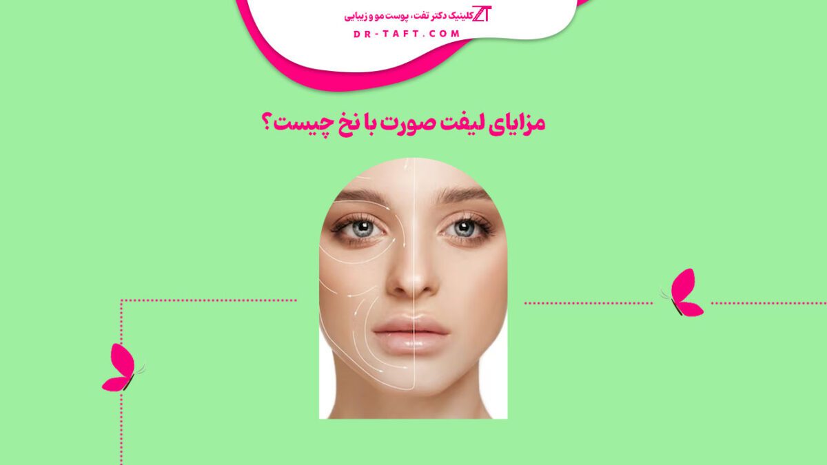 مزایای لیفت صورت با نخ چیست