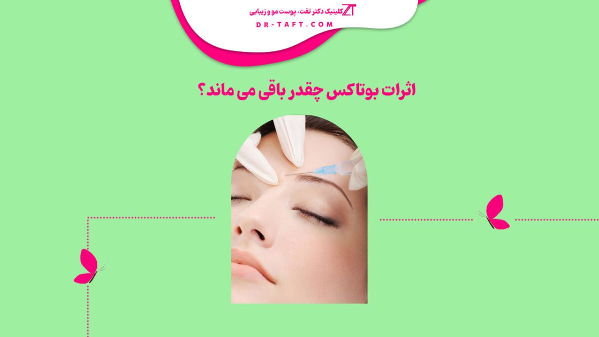 اثرات بوتاکس چقدر باقی می ماند