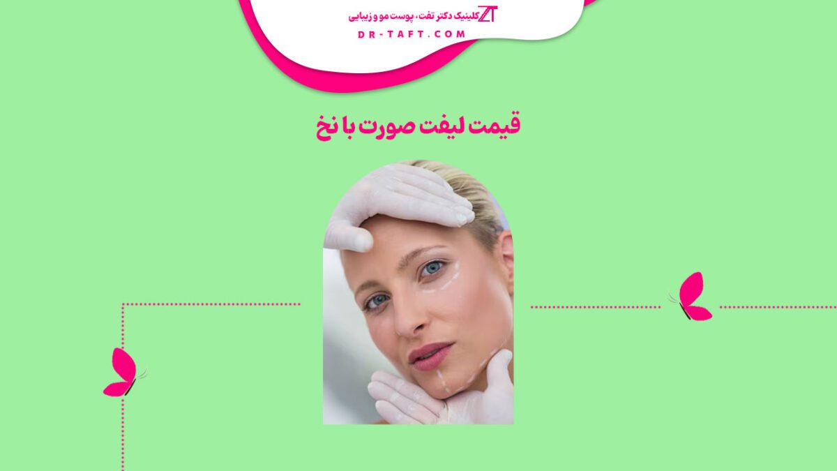 قیمت لیفت صورت با نخ ۱۴۰۲