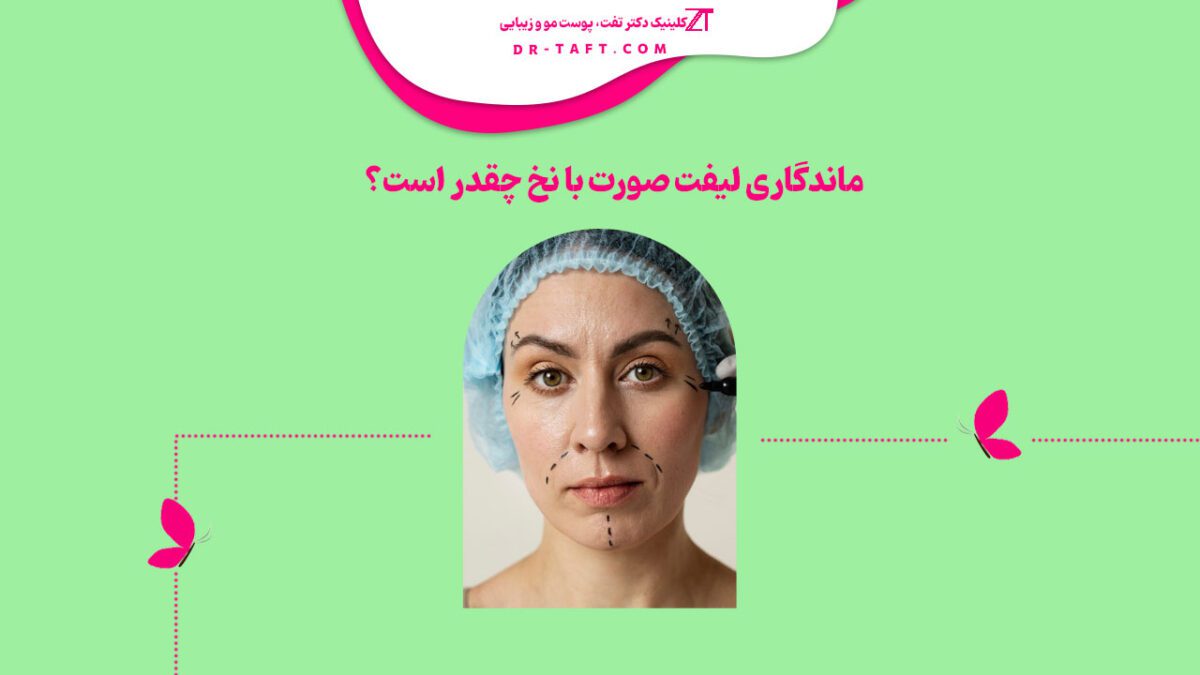 ماندگاری لیفت صورت با نخ