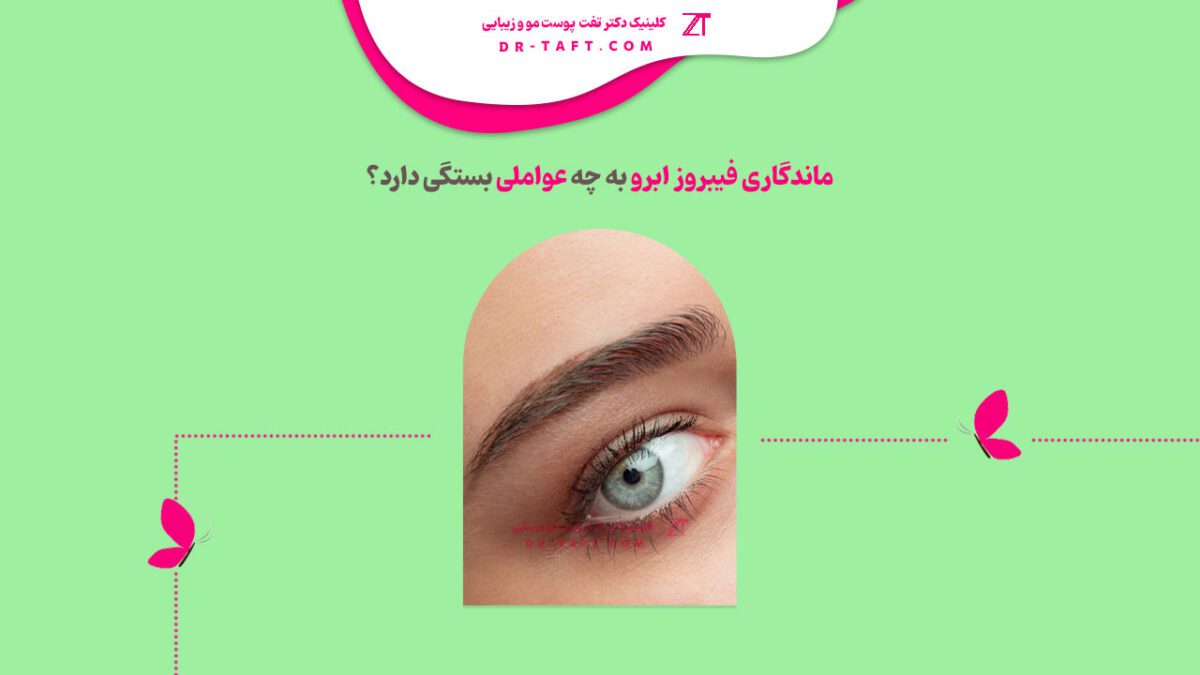 مدت ماندگاری فیبروز ابرو