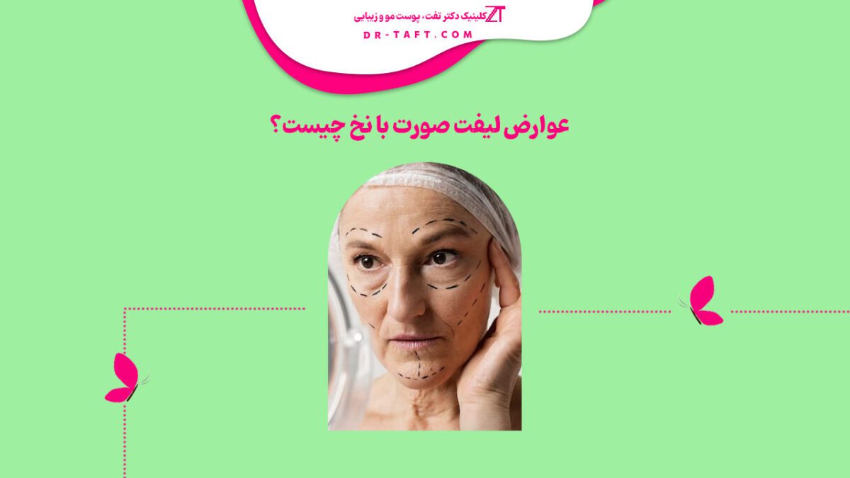 عوارض لیفت صورت با نخ چیست