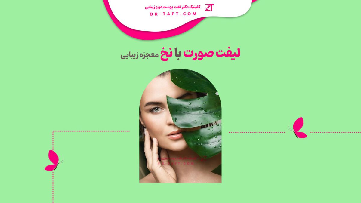 لیفت صورت با نخ معجزه زیبایی