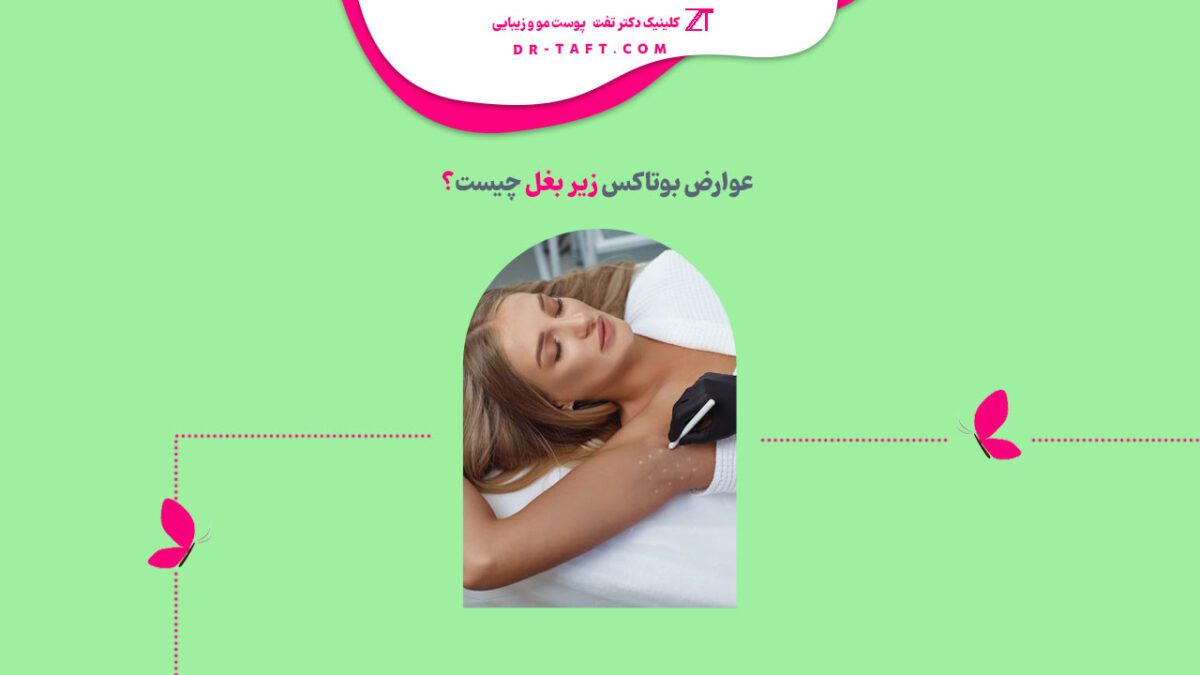 عوارض بوتاکس زیر بغل چیست