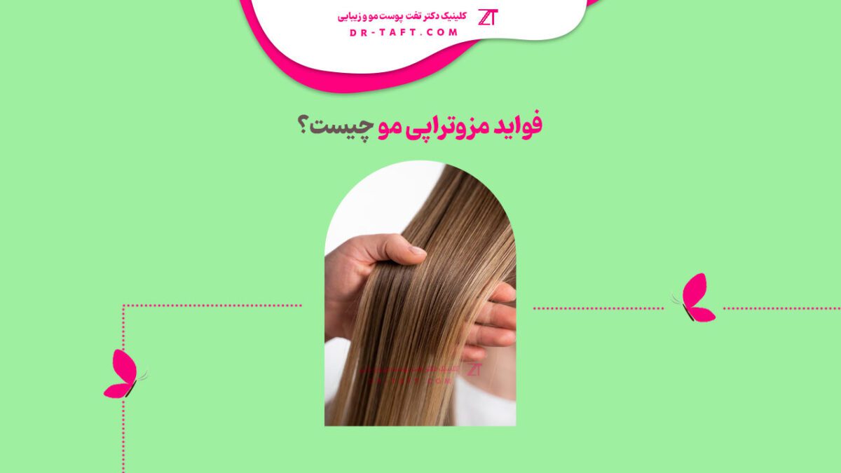 فواید مزوتراپی مو چیست