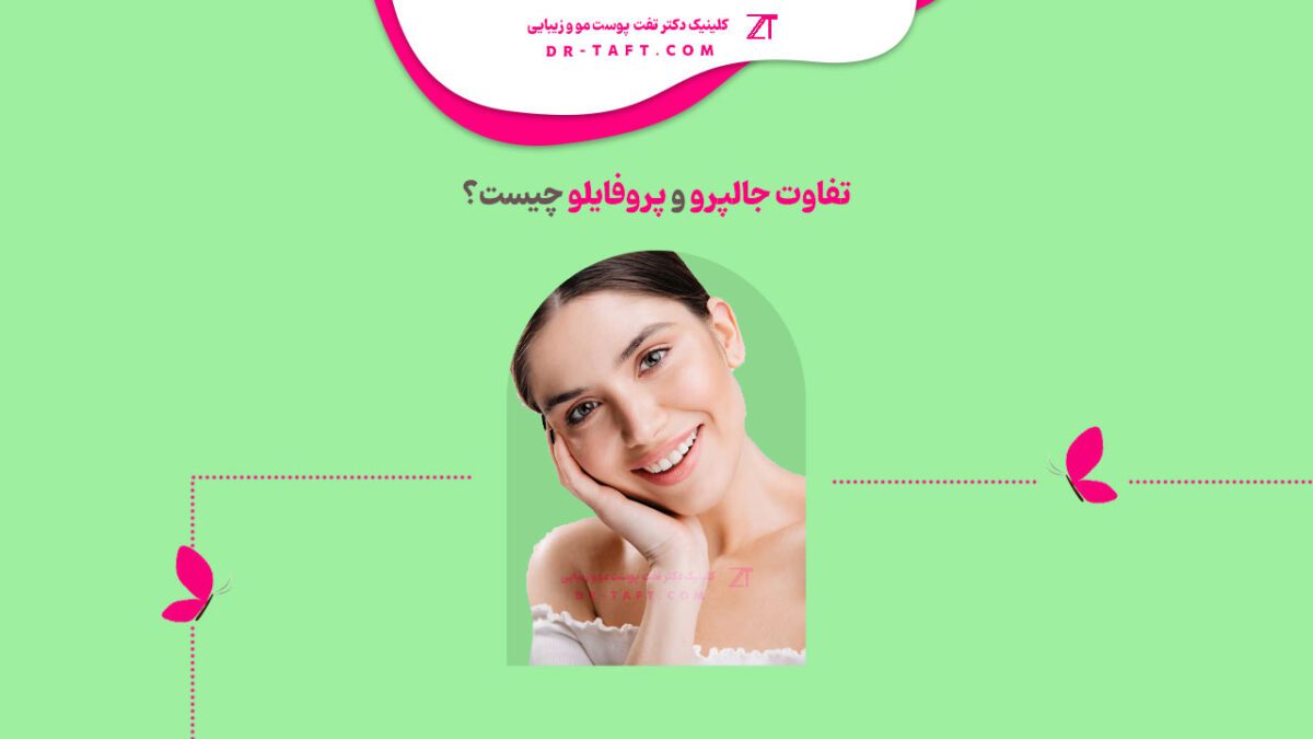 تفاوت جالپرو و پروفایلو چیست