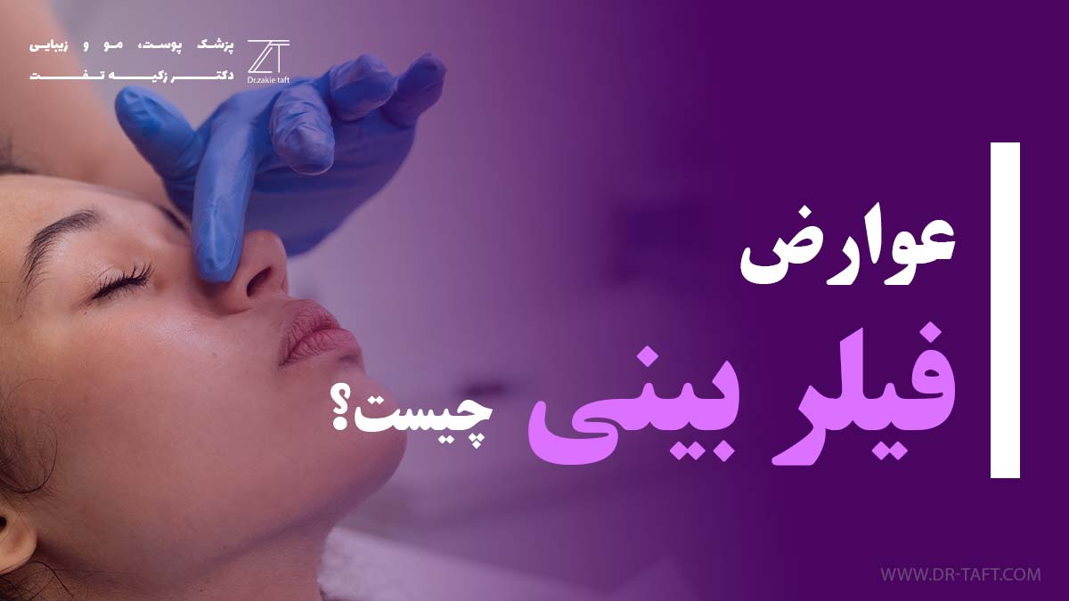 عوارض فیلر بینی