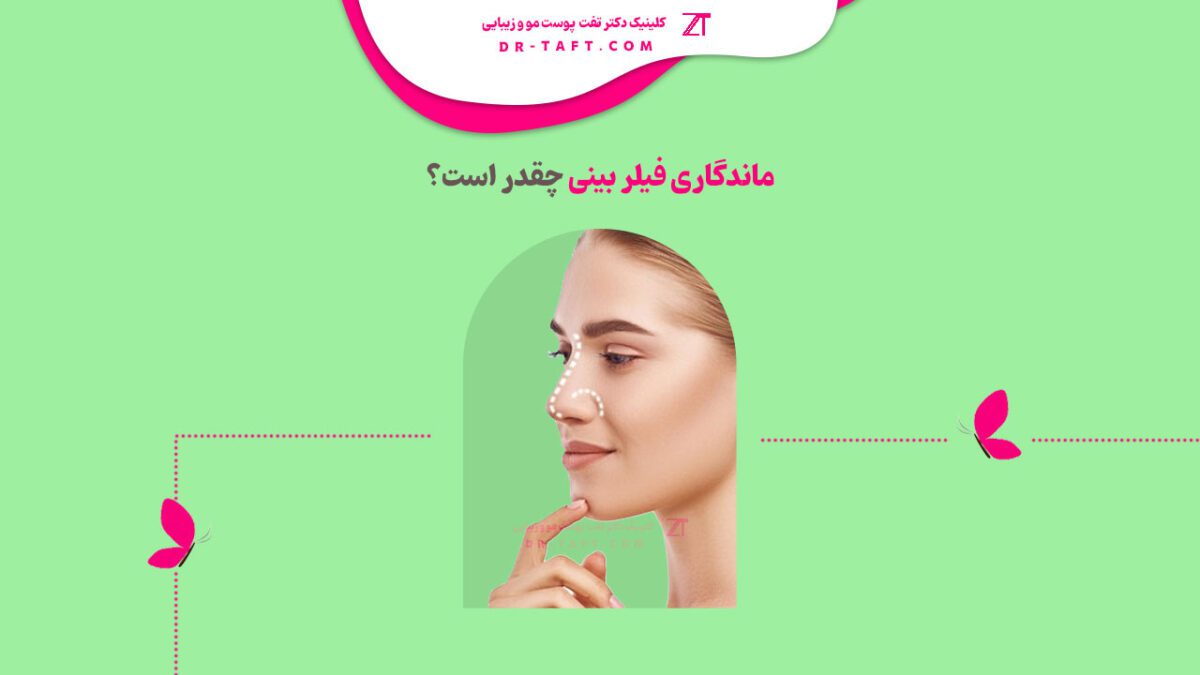 ماندگاری فیلر بینی چقدر است