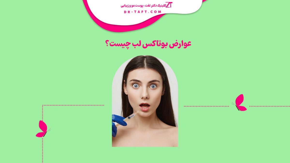عوارض بوتاکس لب چیست