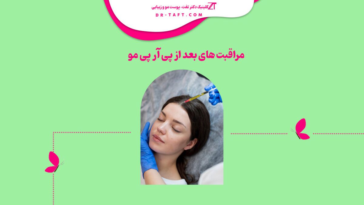 مراقبت های بعد از پی آر پی مو