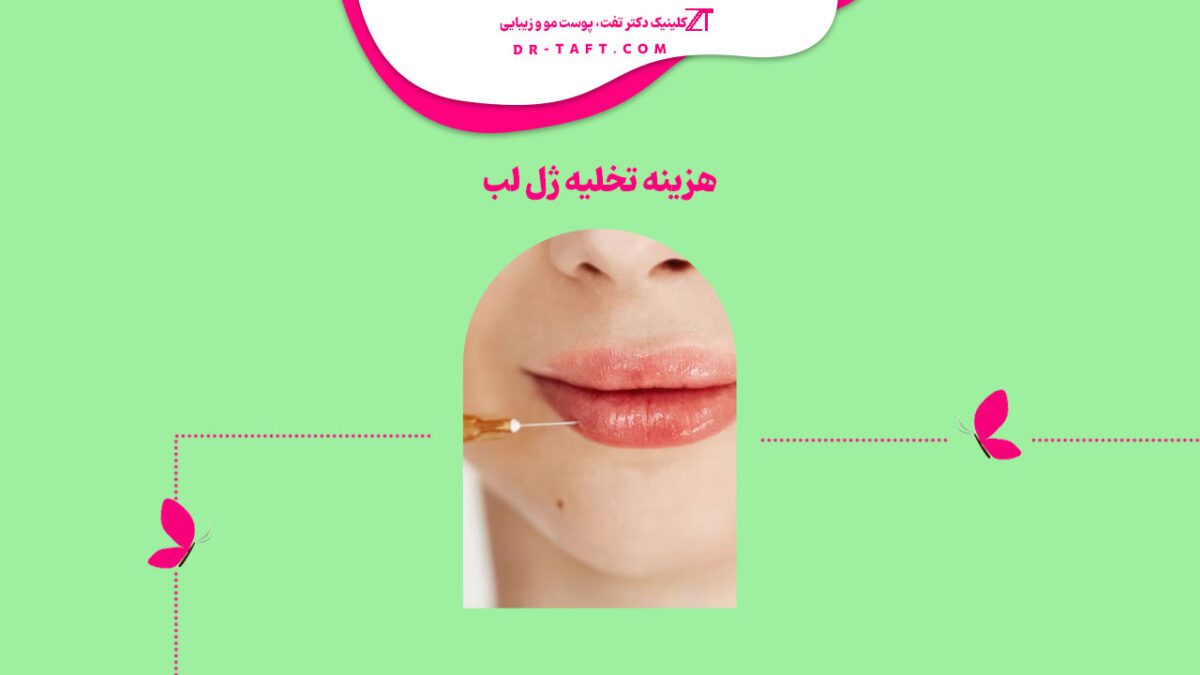 هزینه تخلیه ژل لب