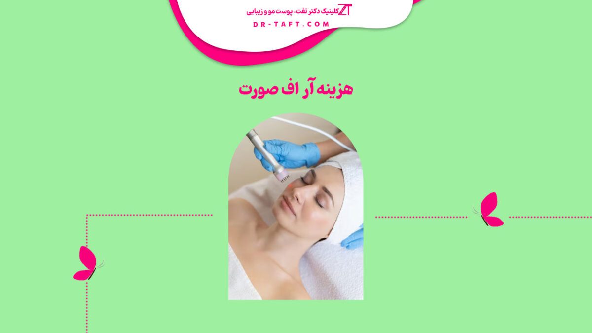 هزینه آر اف صورت