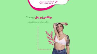بوتاکس زیر بغل چیست