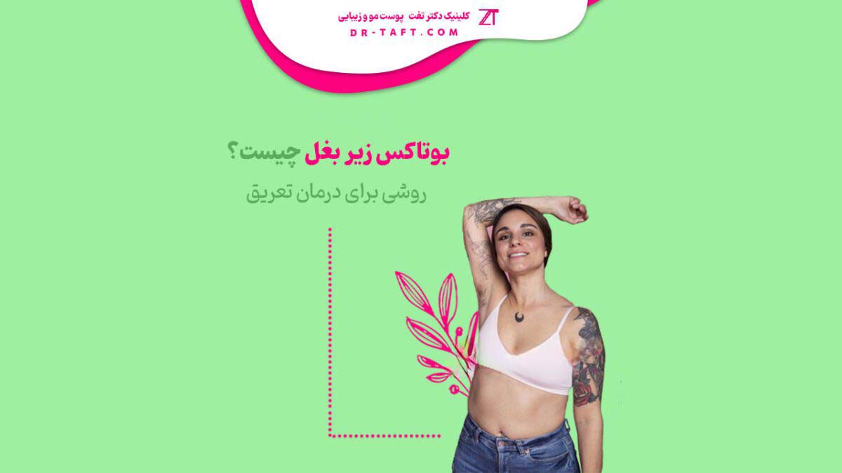 بوتاکس زیر بغل چیست